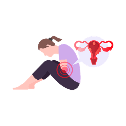 Fibromas uterinos